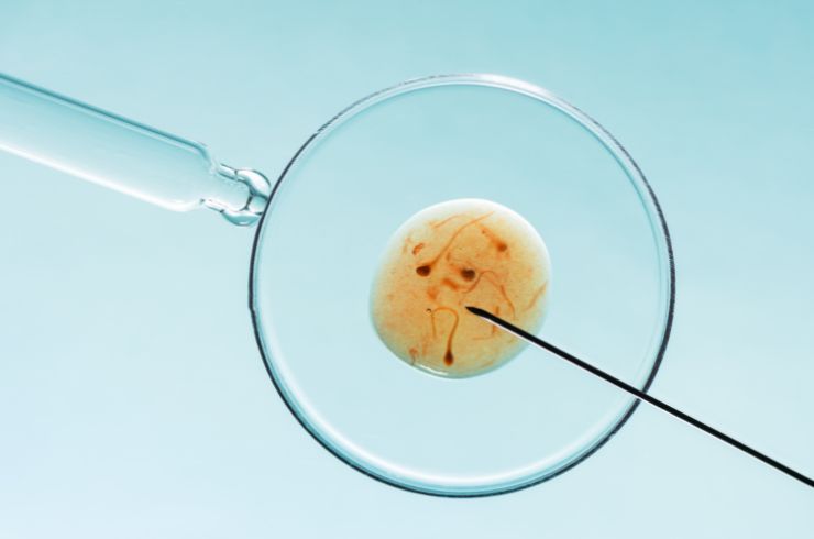 In Vitro Fertilization