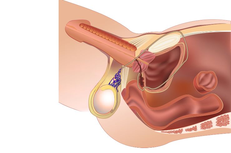 Testicular Biopsy